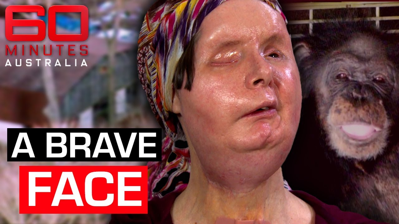 Single mother’s extraordinary survival story after violent chimpanzee attack | 60 Minutes Australia