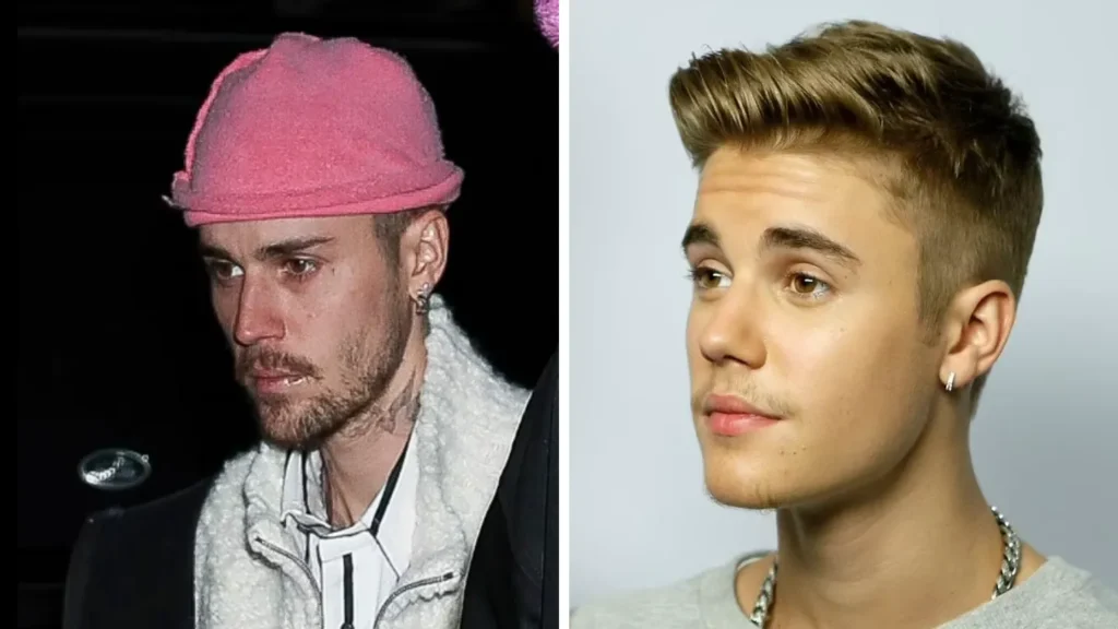 Justin Bieber’s Changing Appearance Sparks Concern Amid Marital Struggles