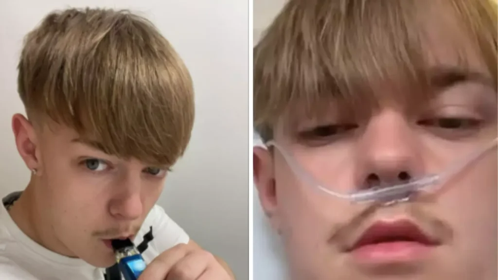 Teen Who Vaped Equivalent of 50 Cigarettes a Day Coughs Up Pints of Blood in Shocking Health Scare